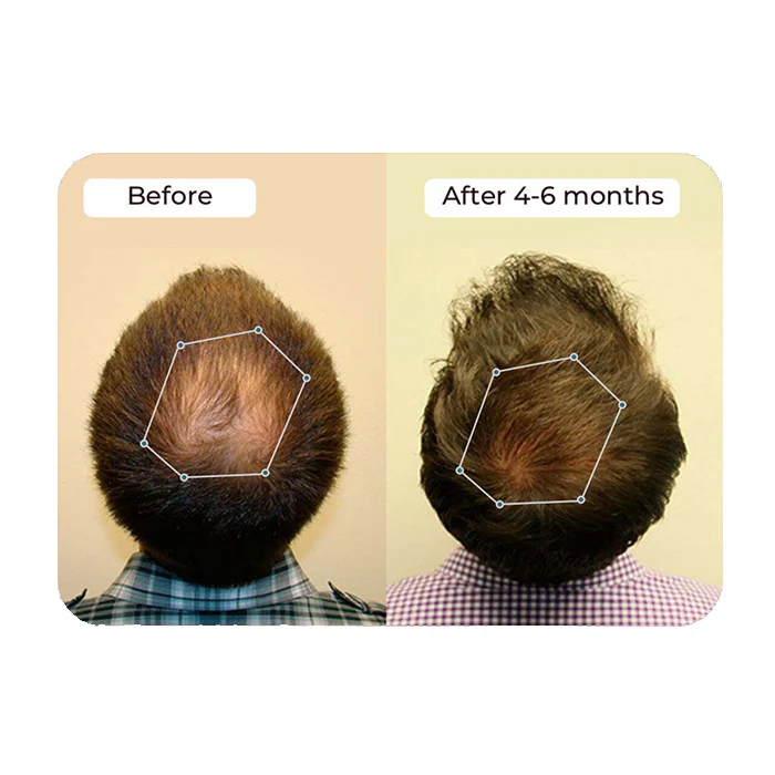 Vital Hair Complex - Image 7