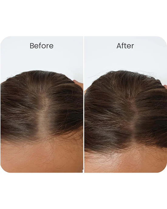 Vital Hair Complex - Image 4